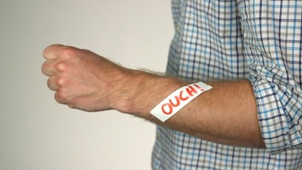 How to Treat a Cut Without Antibiotic Cream