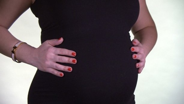 Too many C-sections