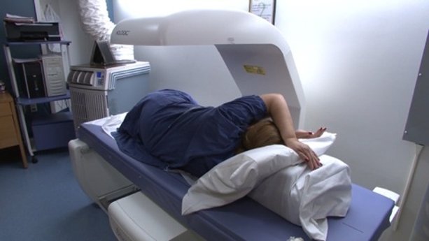 Treating Osteoporosis