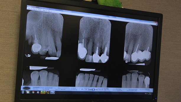 Cómo visitar al dentista sin seguro médico