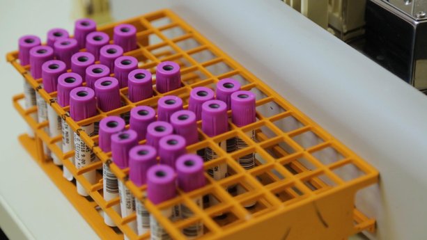 La causa de la anemia