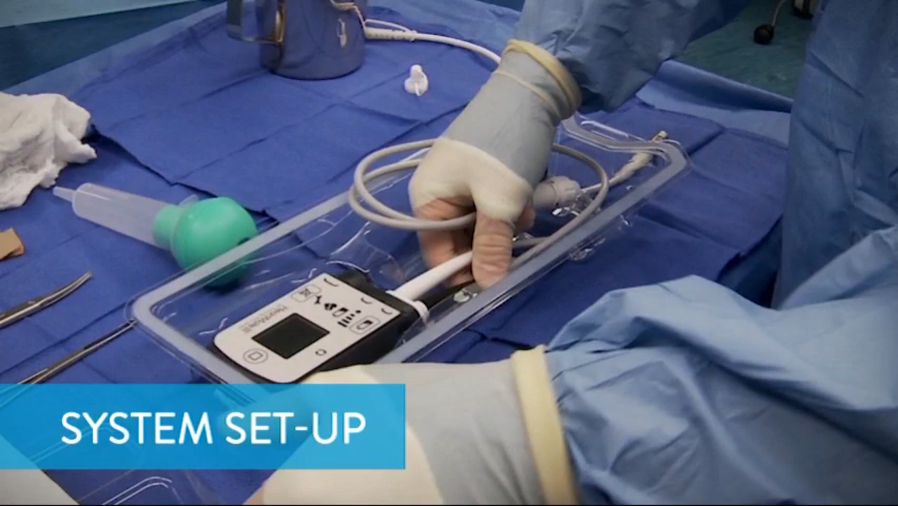 HeartMate 3 LVAD System Information | Abbott