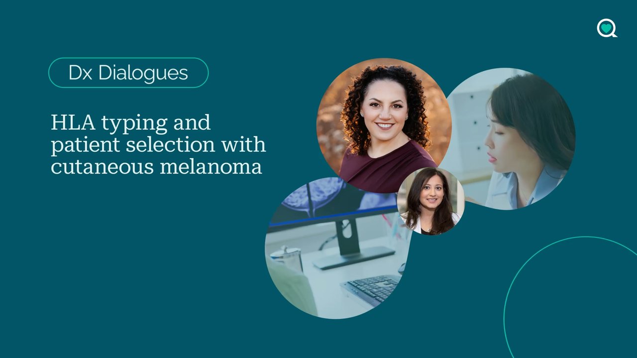 Dx Dialogues: HLA typing and patient selection with cutaneous melanoma