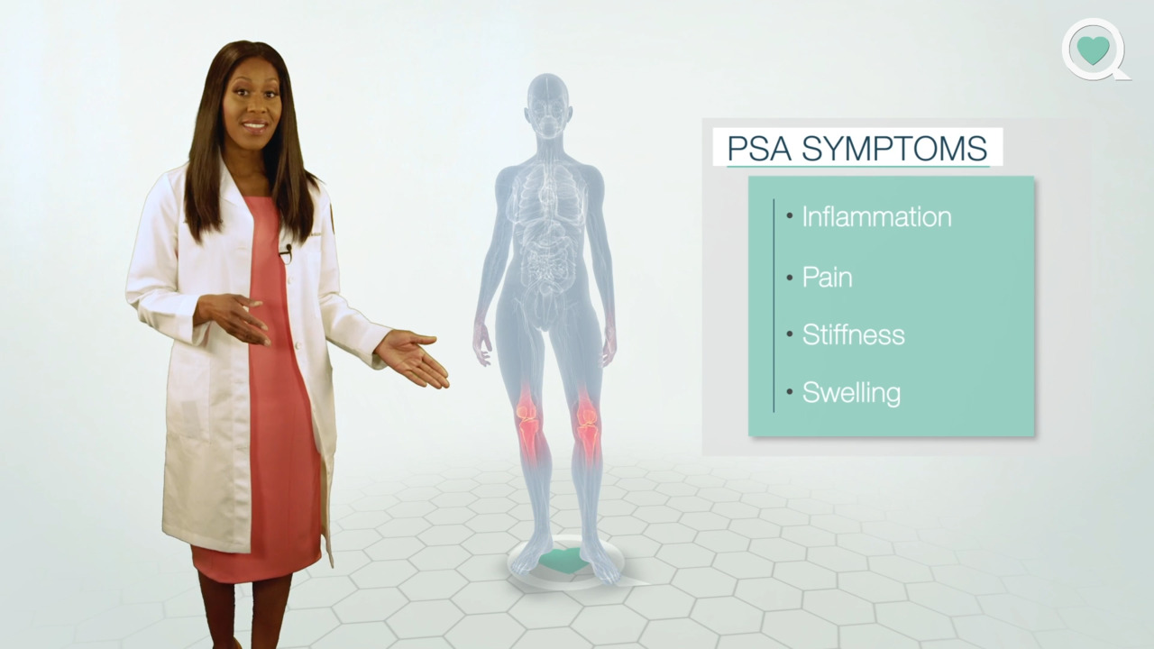 A virtual look at psoriatic arthritis with Dr. Caudle