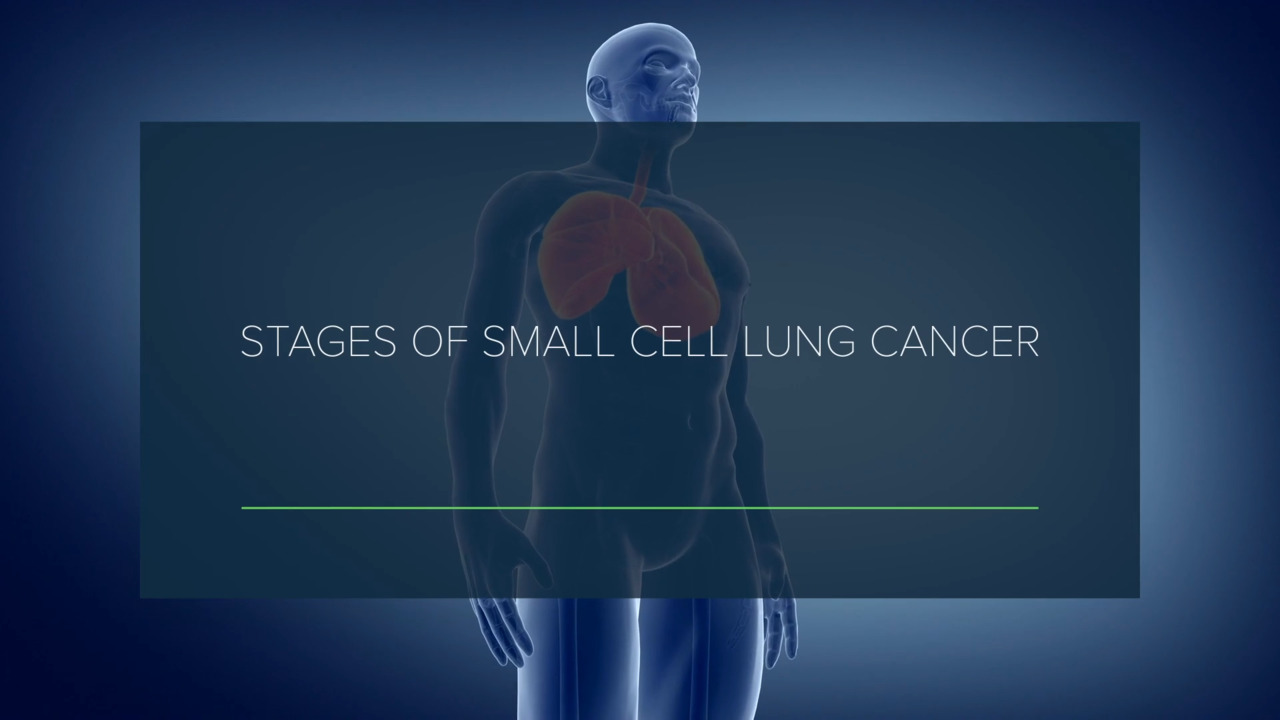Stages of Small Cell Lung Cancer