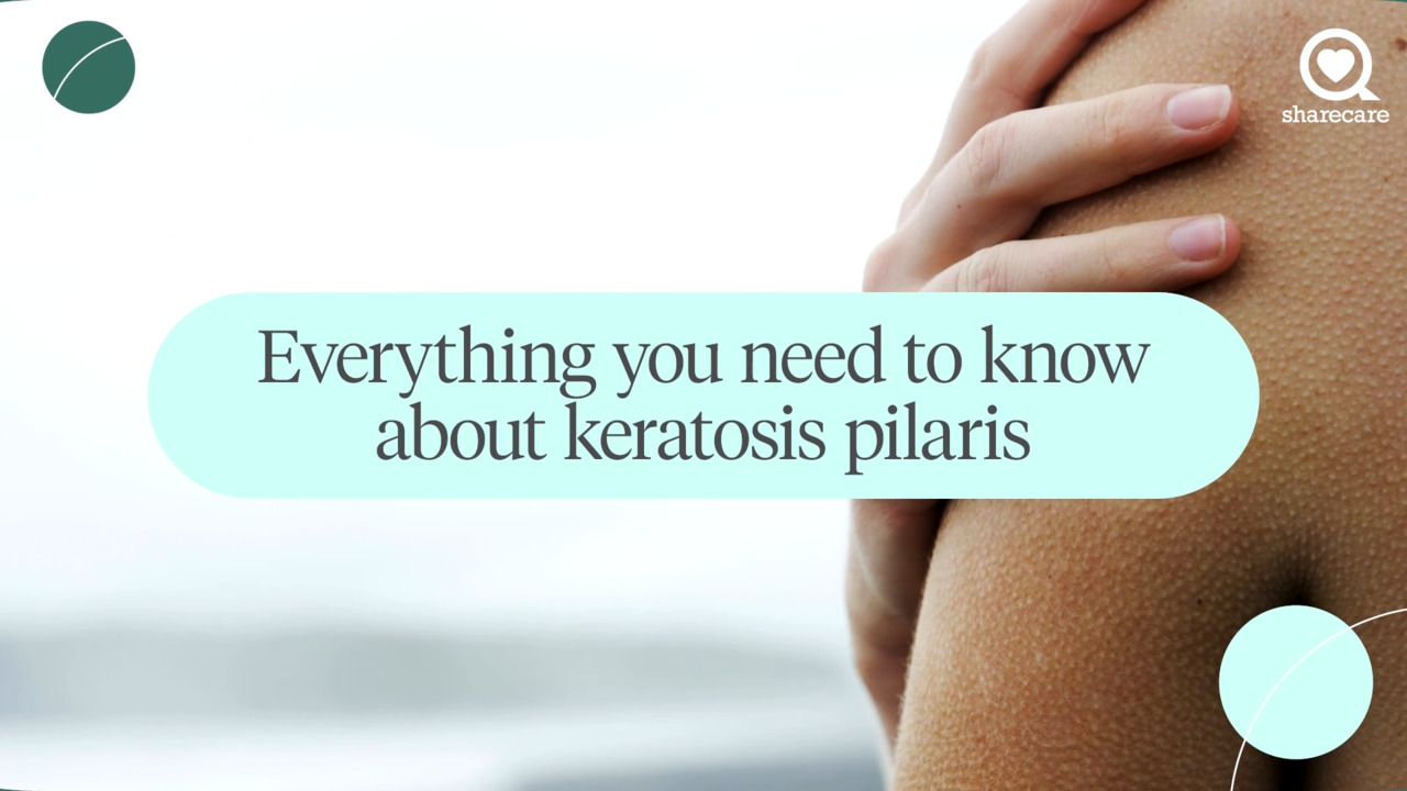 Everything you need to know about keratosis pilaris