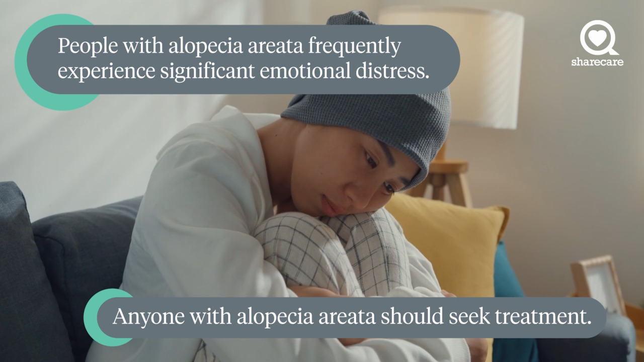 What medications treat alopecia areata