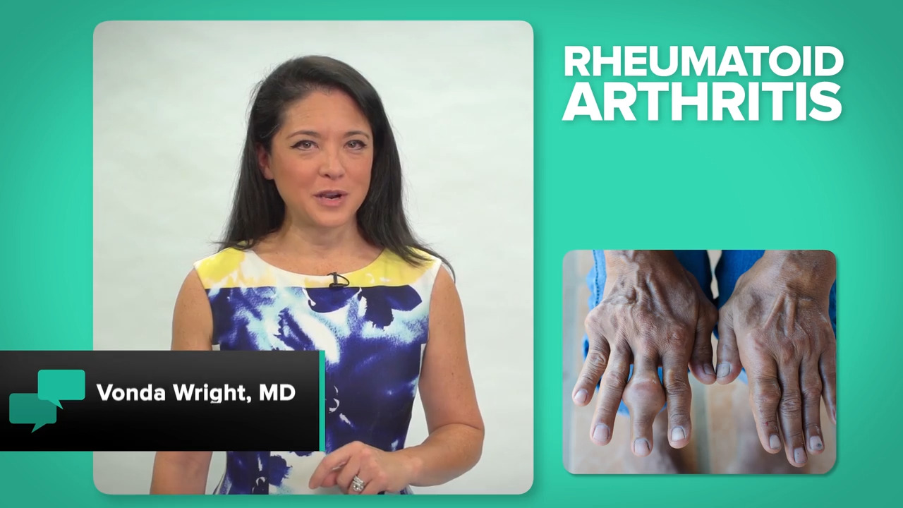 Rheumatoid arthritis risks and causes