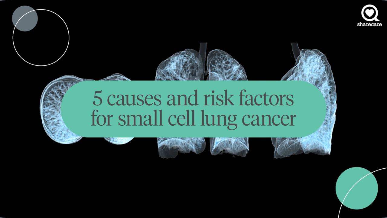 5 causes and risk factors for small cell lung cancer