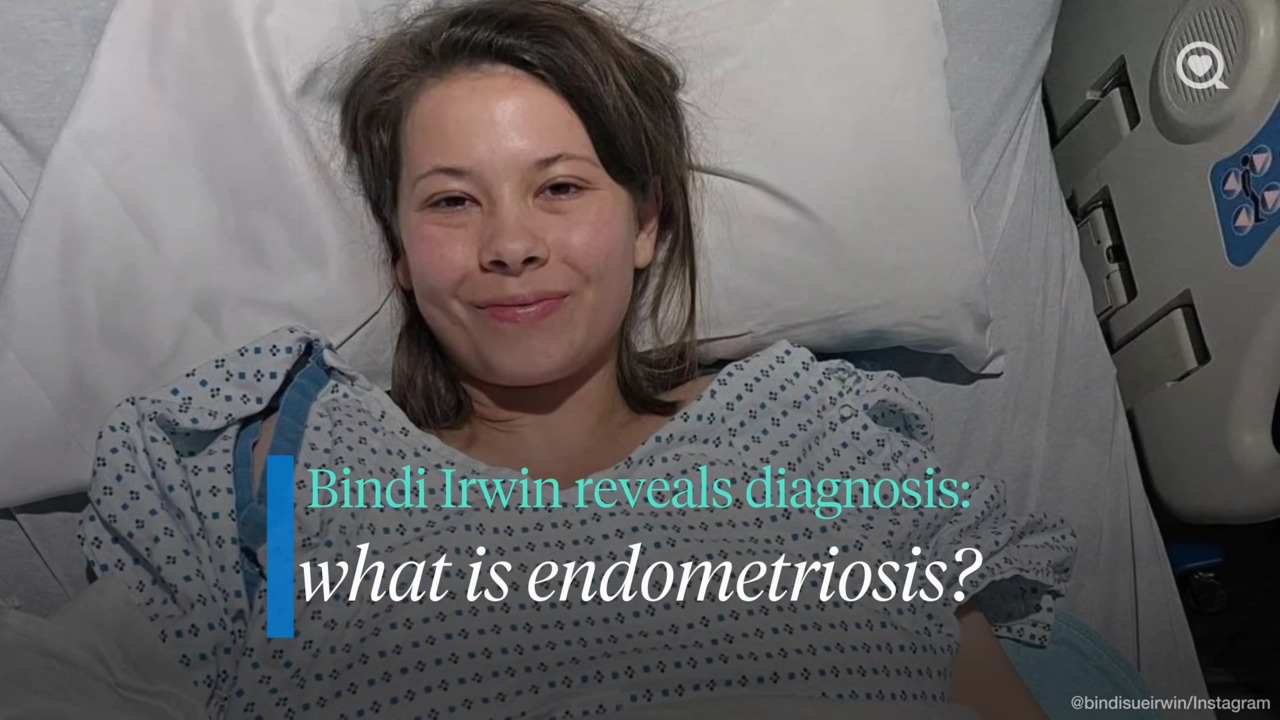 Bindi Irwin reveals diagnosis: what is endometriosis?