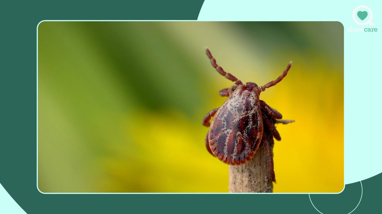 4 tips to stop ticks and prevent lyme disease