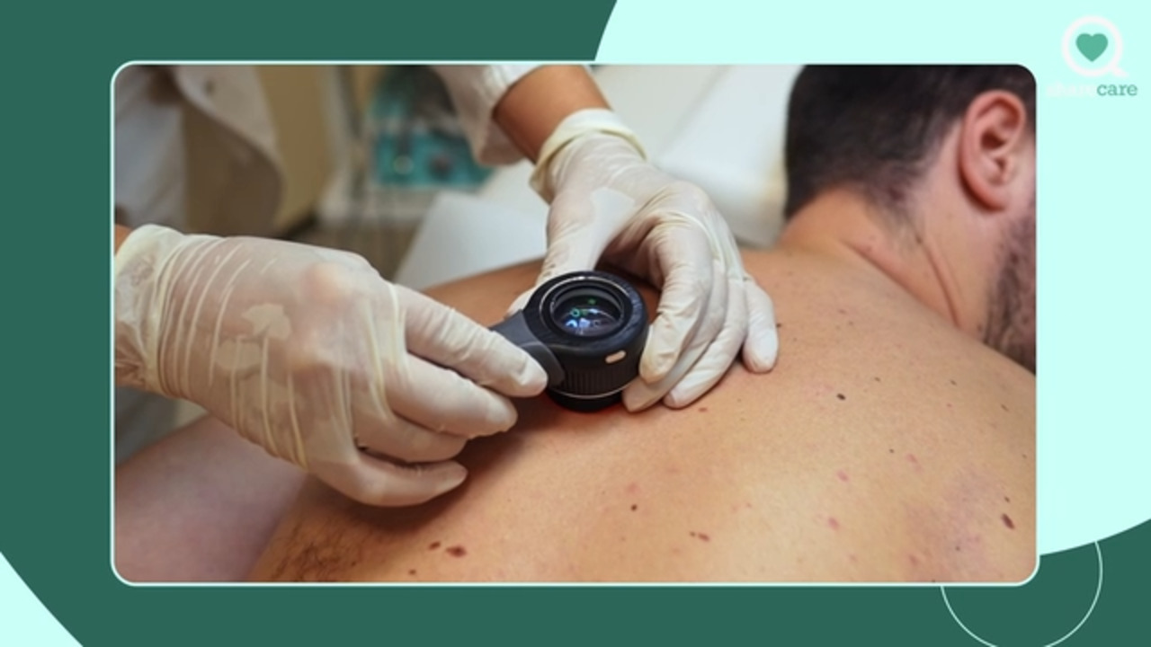 How will my doctor examine me for skin cancer?