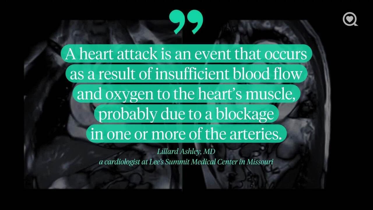 What is the difference between cardiac arrest and a heart attack?