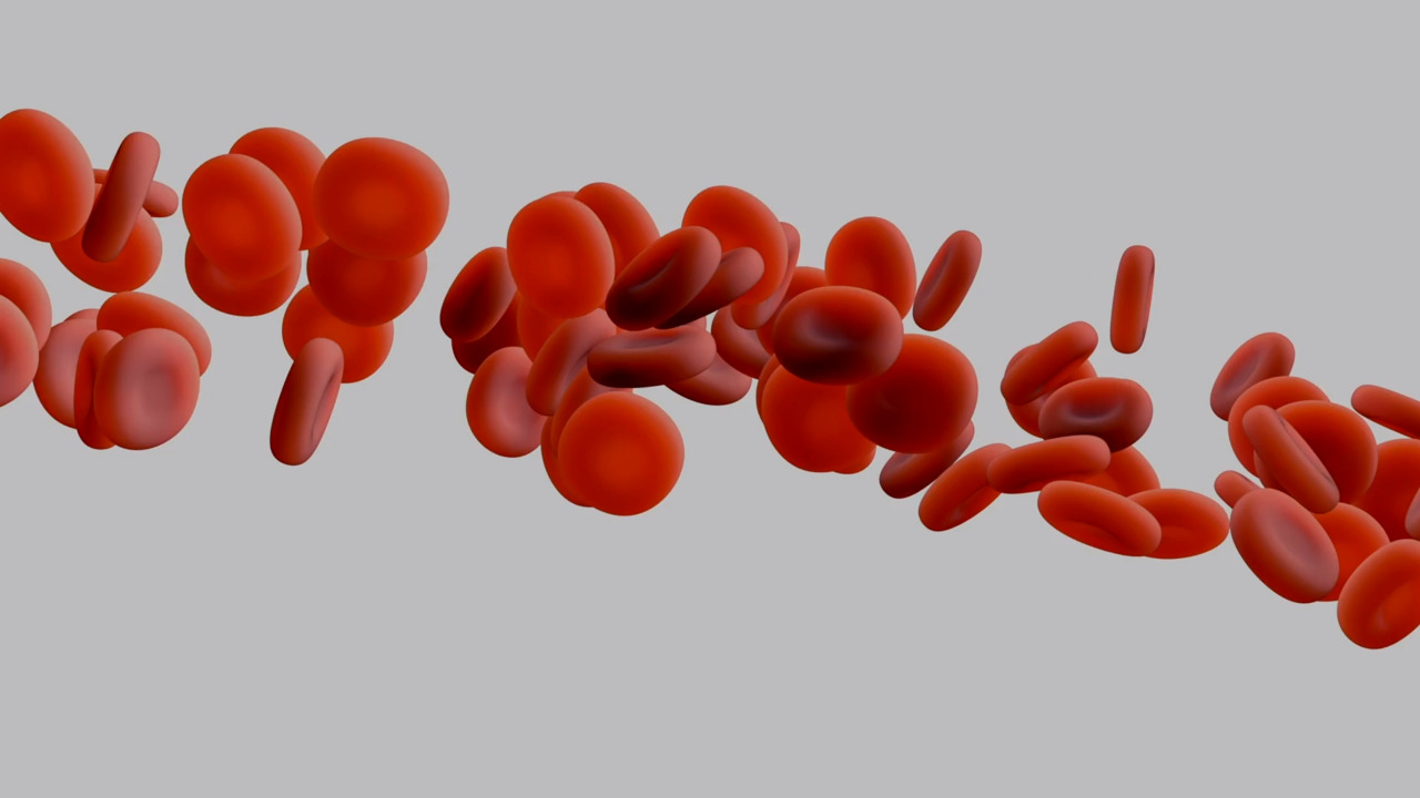what is anemia ?