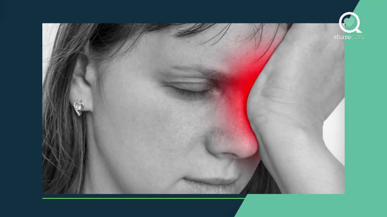 5 most common migraine questions answered - part 1