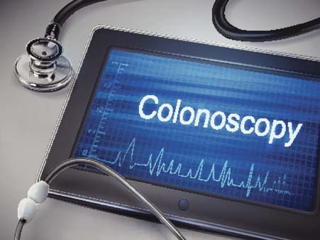 time for a colonoscopy ? 3 things you should know