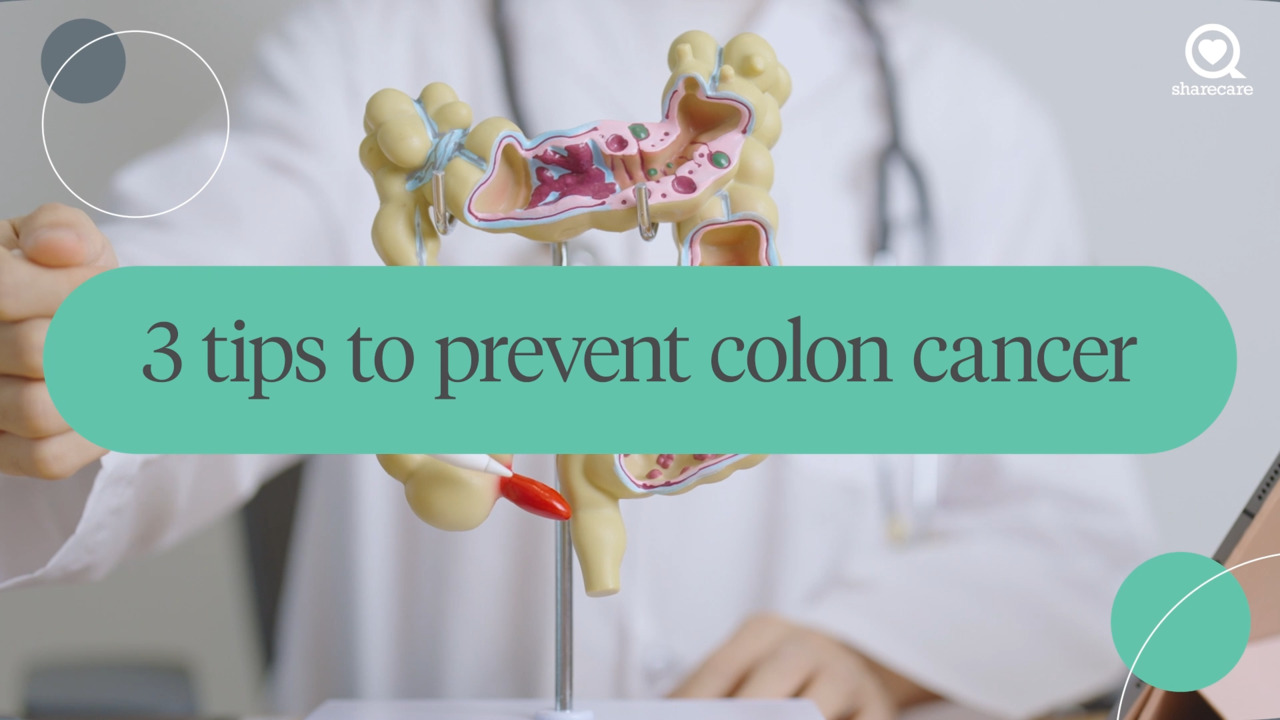 3 tips to prevent colon cancer