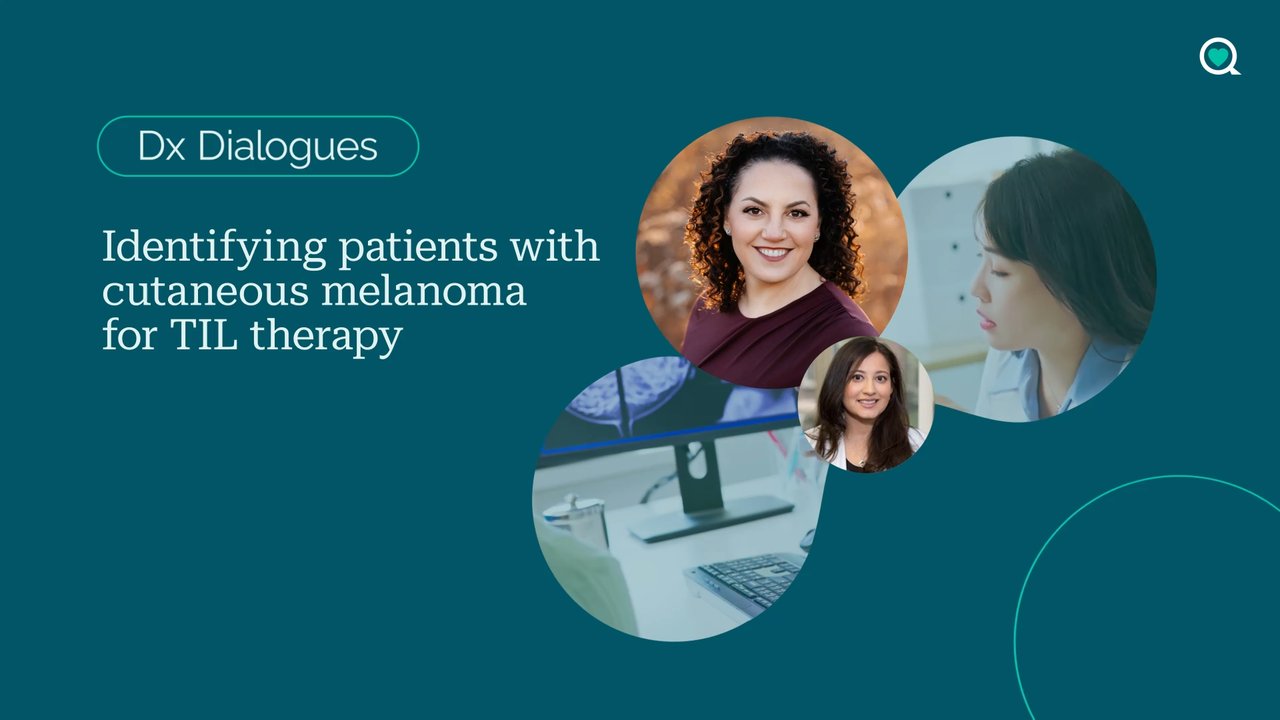 Dx Dialogues: identifying patients with cutaneous melanoma for TIL therapy