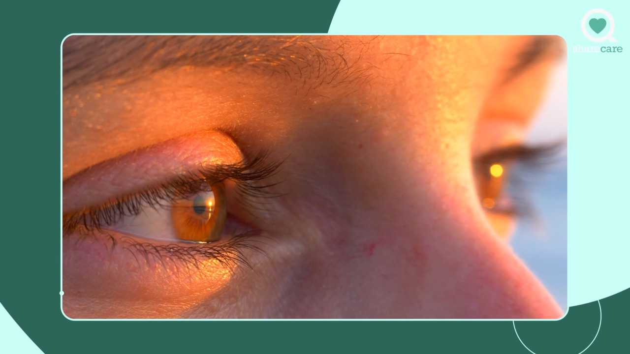 What causes styes in the eyes?