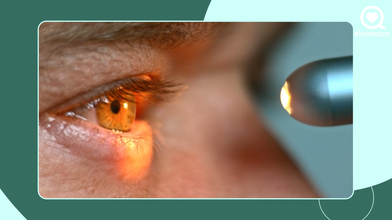 What are my options for cataract surgery?