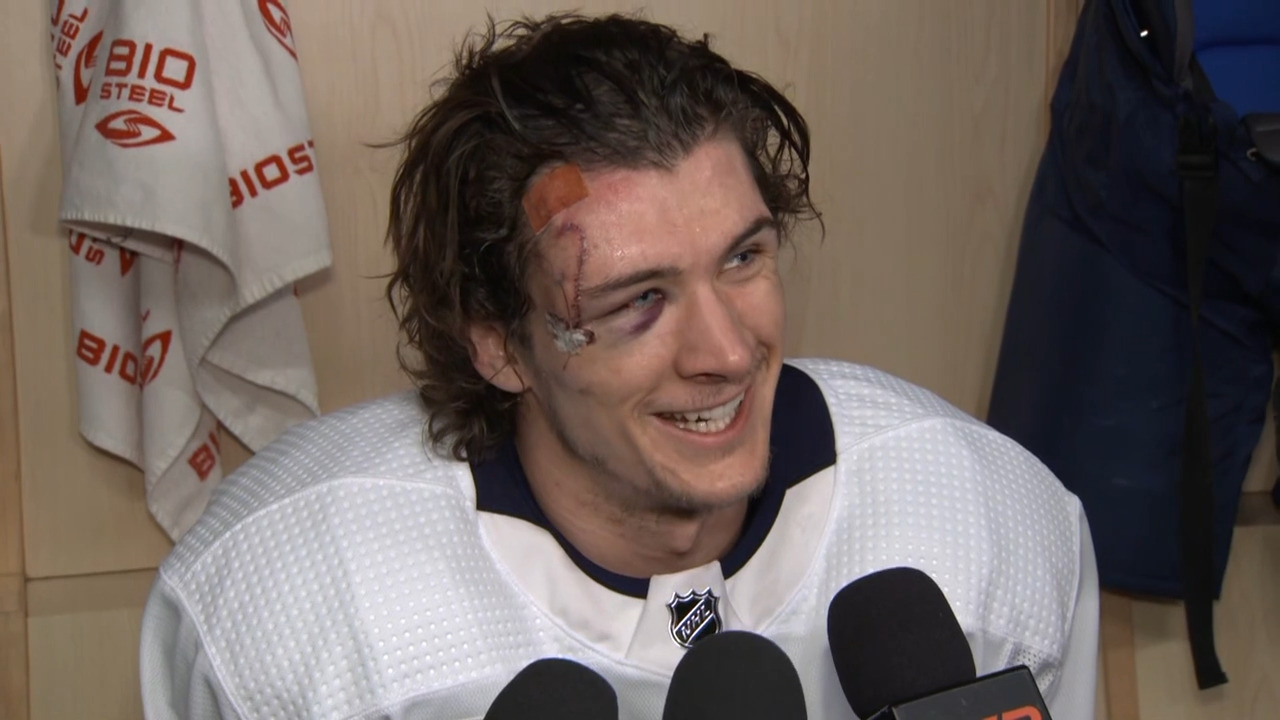 Chandler Stephenson helped Morgan Barron after skate blade to face  necessitated 75 stitches: 'It was obviously a really classy move