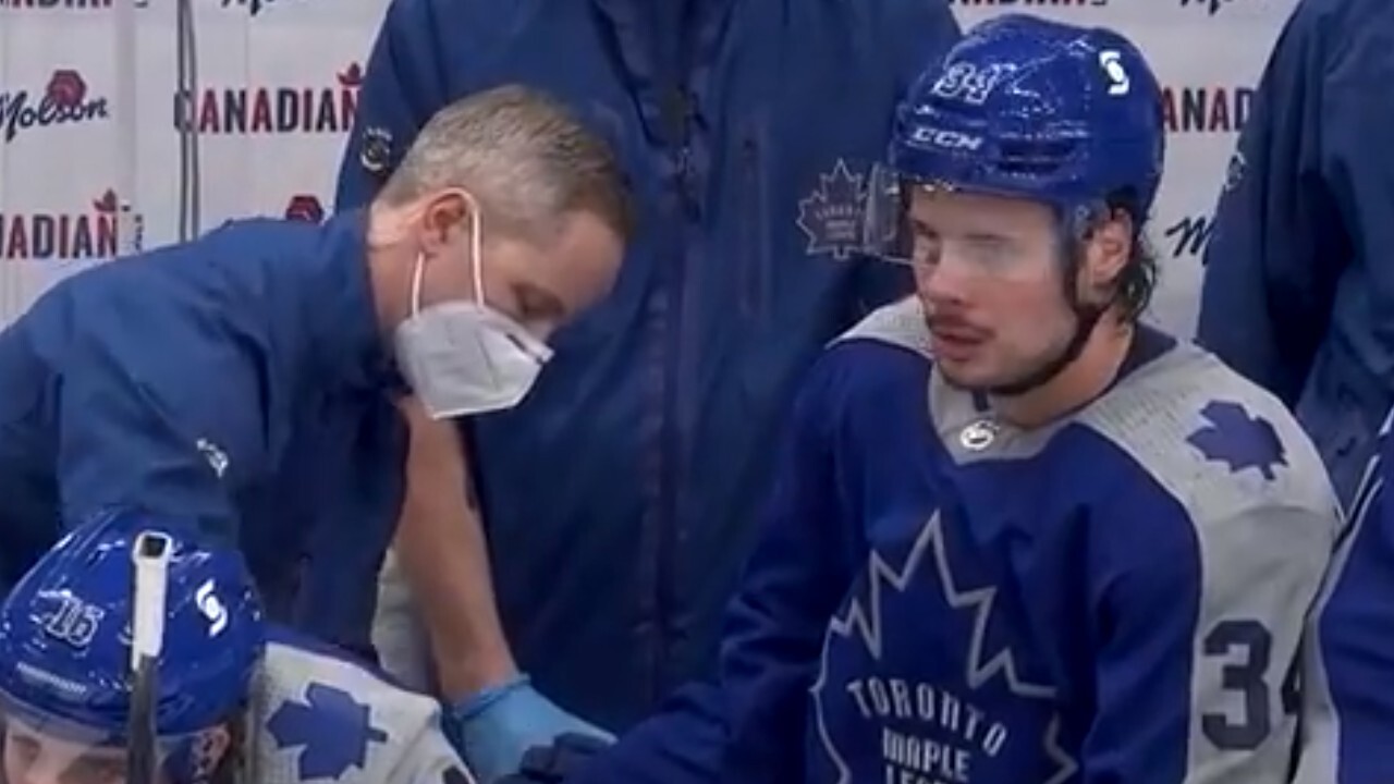 Leafs' Star Player Matthews Suffers Painful Injury After Taking