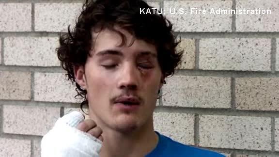 cigarette électronique japonaise Brûlé par l'explosion de sa cigarette électronique, il perd 7 dents