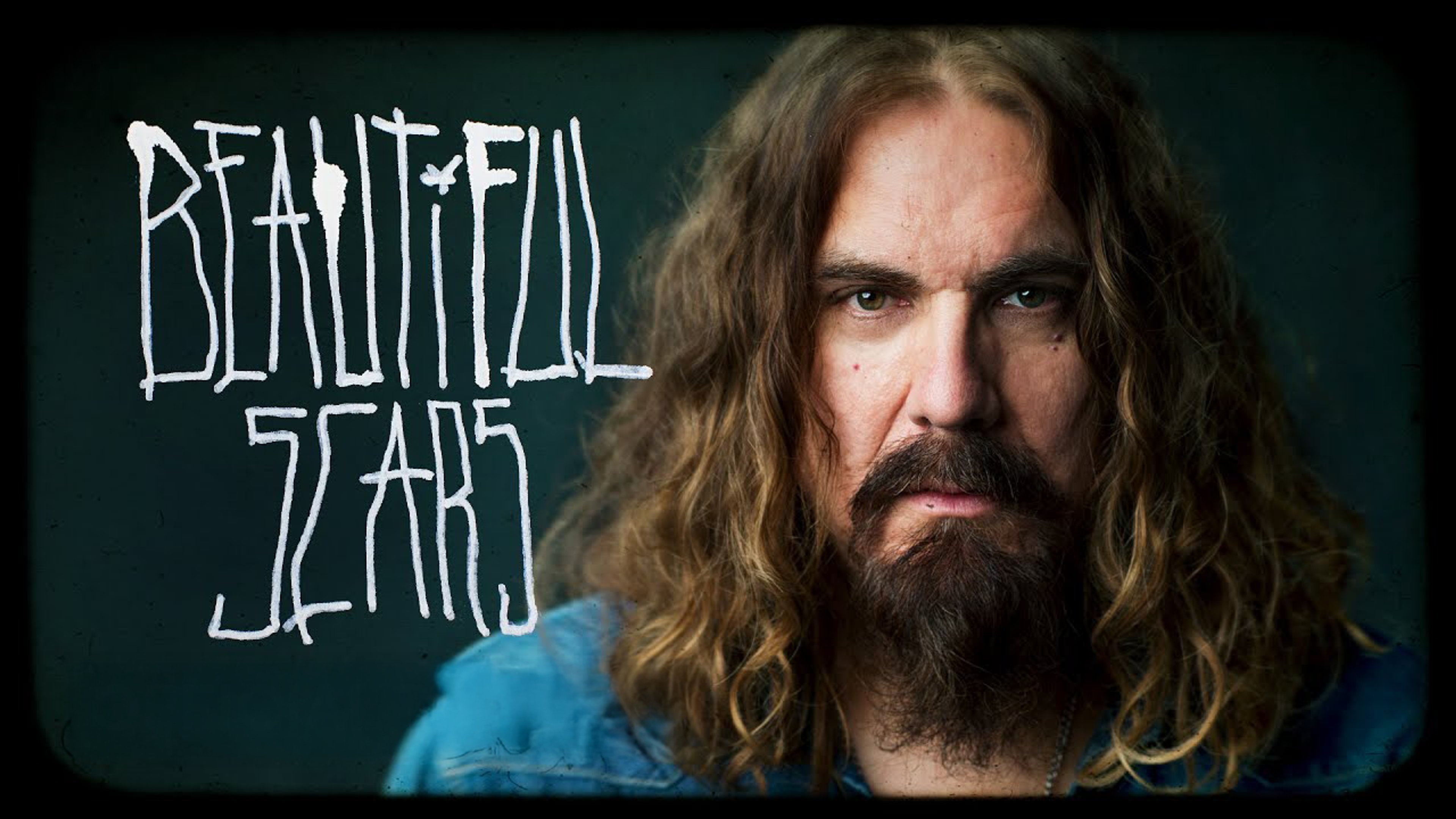 Beautiful Scars | TVO Today