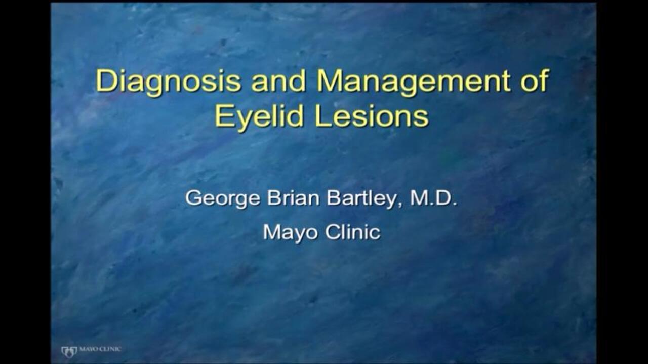 Eyelid Disorders Diagnosis And Management American