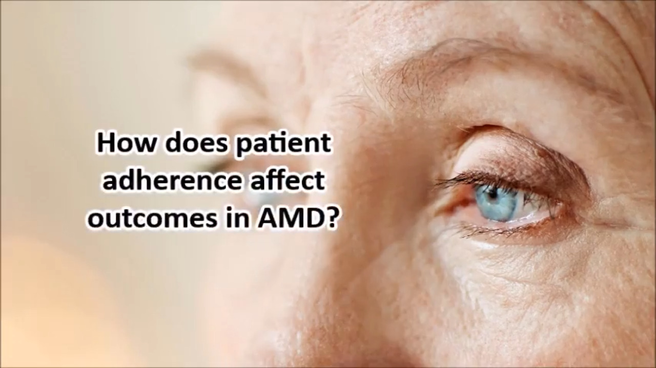 VIDEO: Importance of adhering to follow-up recommendations for AMD treatment