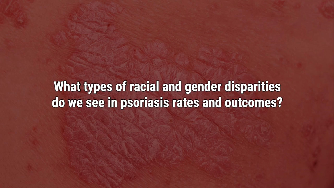 VIDEO: Racial, gender disparities in psoriasis care