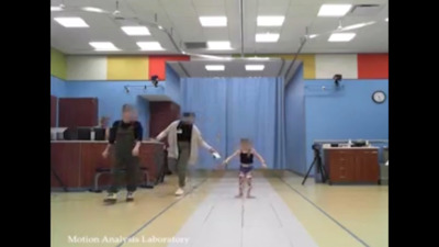 VIDEO: Analysis of patient with worsening hip pain, altered gait mechanics