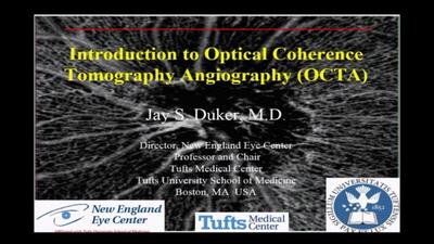 VIDEO: OCT Angiography: What it is and what it is good for
