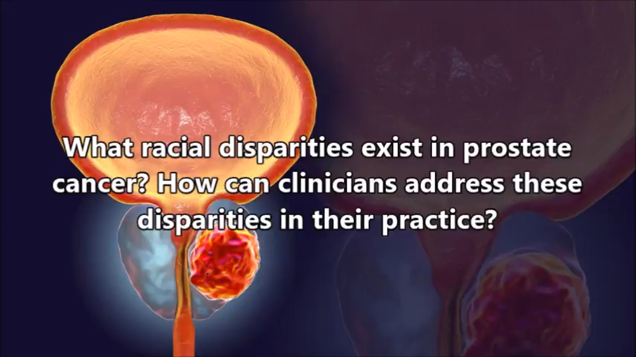 VIDEO: Addressing racial disparities in prostate cancer