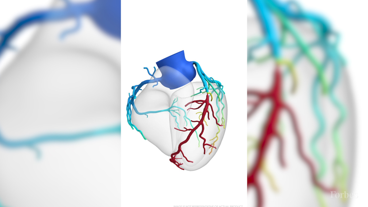 A New Way Of Looking Into The Heart - vein roblox hack free
