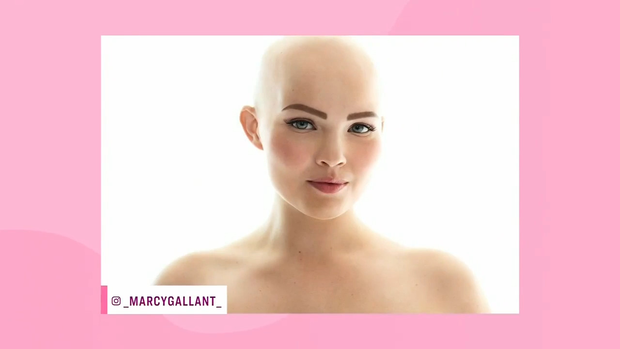 3 women explain why being bald empowers them