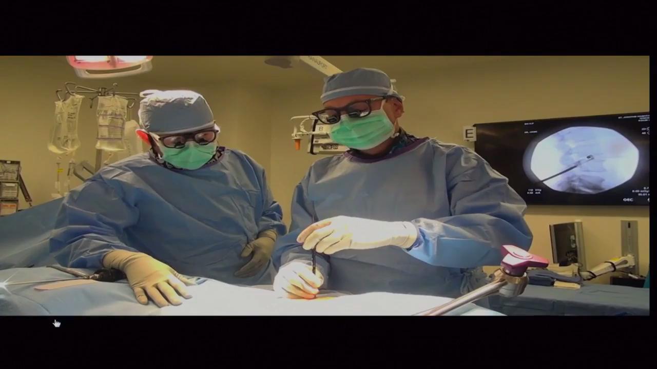Dr. Uribe: XLIF Spine Surgery