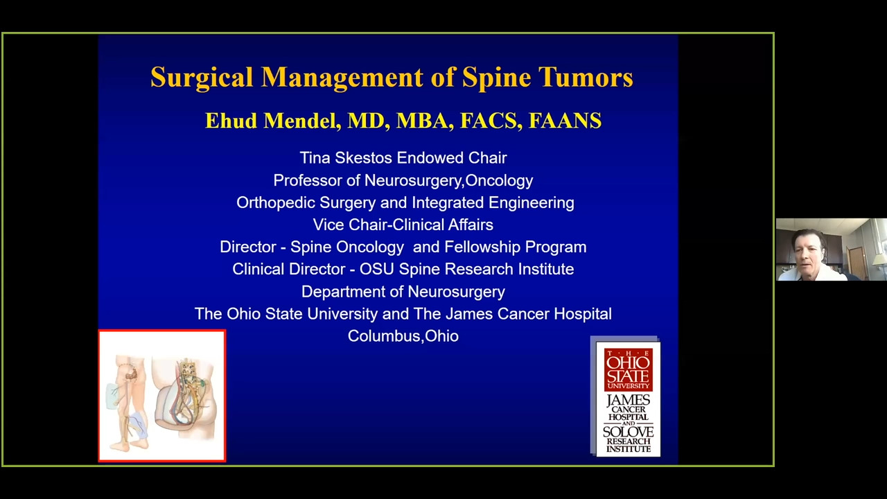Surgical Management of Spine Tumors