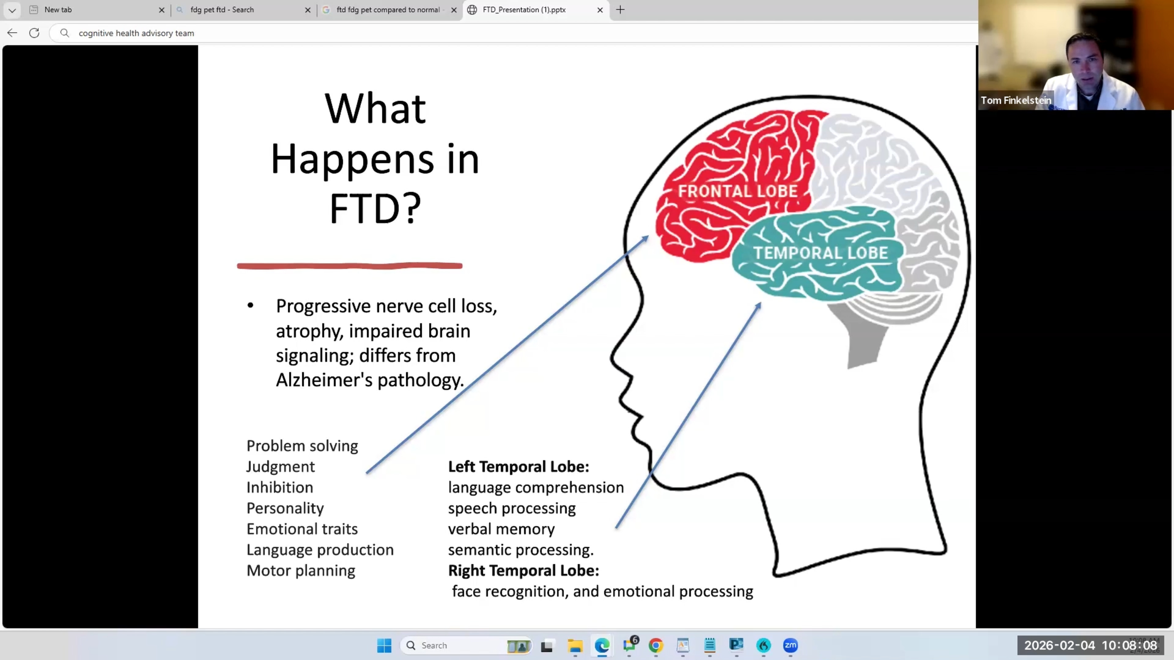 Understanding Frontotemporal Dementia