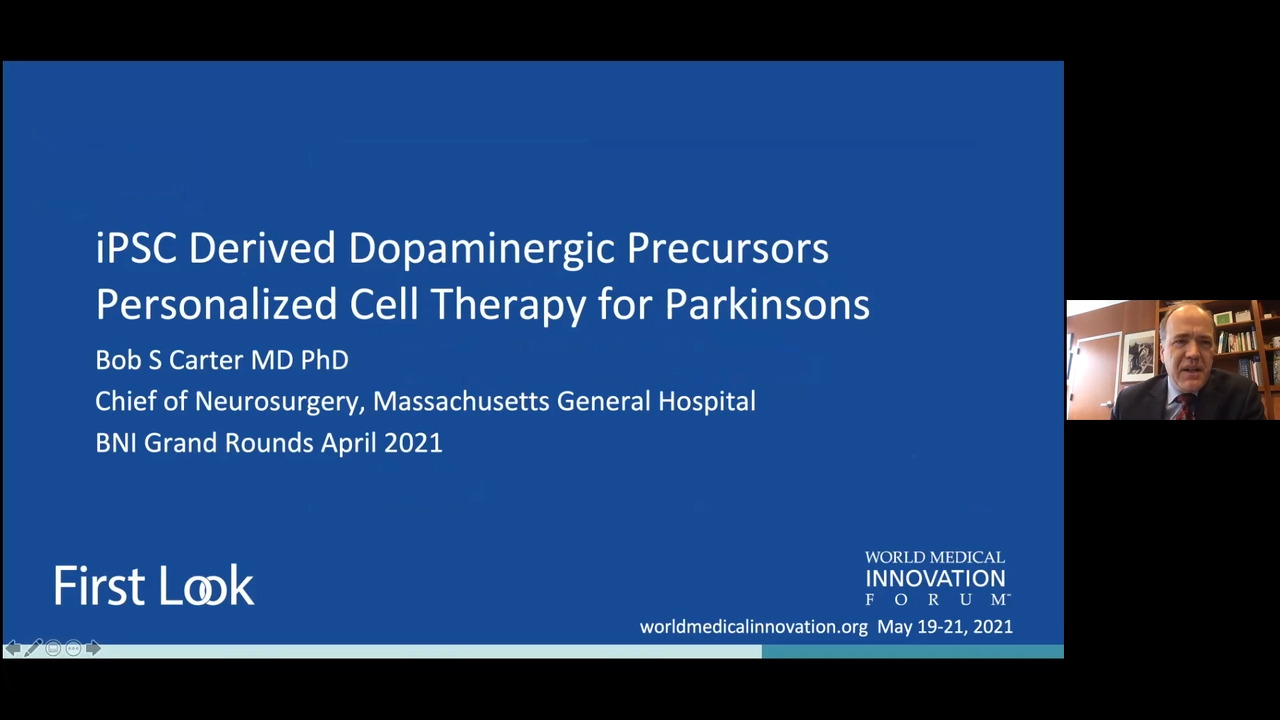 iPCS Derived Dopamingeric Precursors Personalized Cell Therapy for Parkinson's