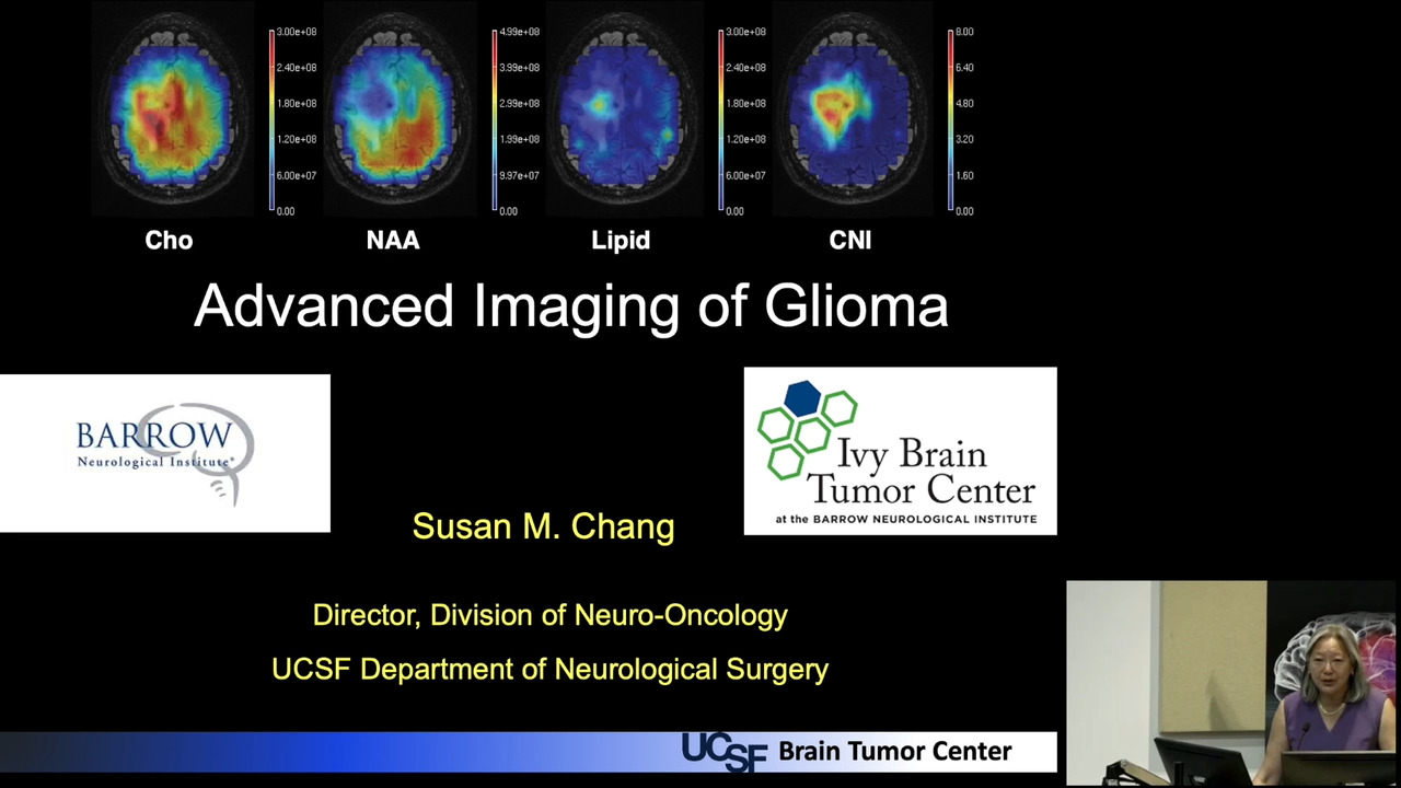 Advanced Imaging of Glioma