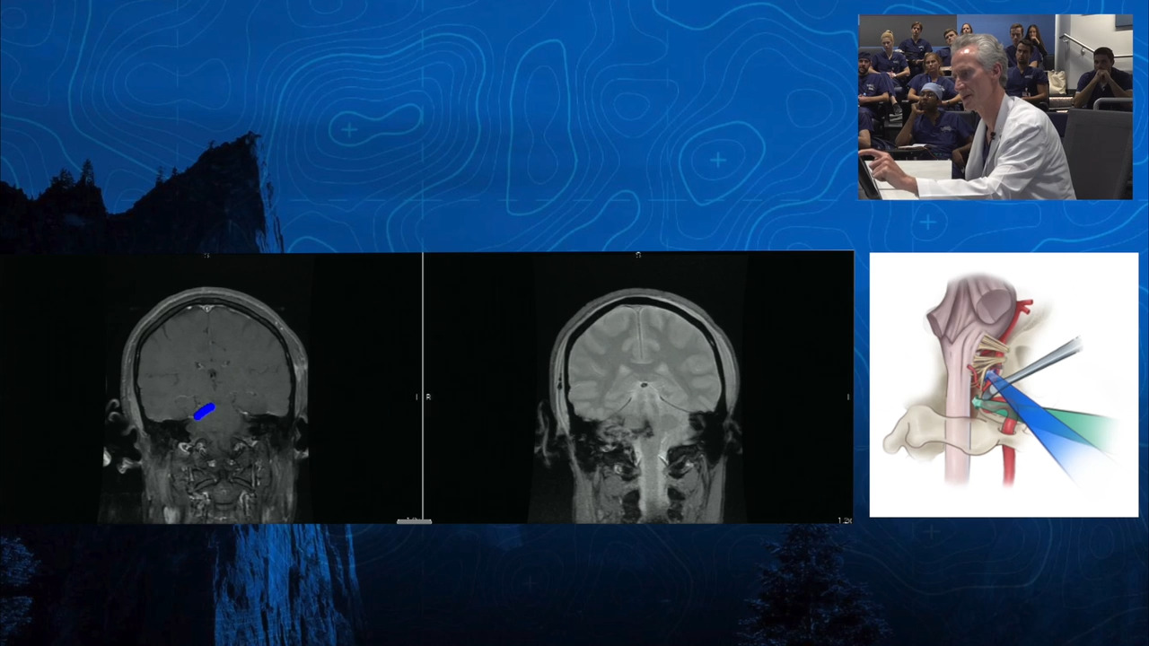 Episode 2: Perfect - Pontomedullary & Cerebellar Cavernous Malformation