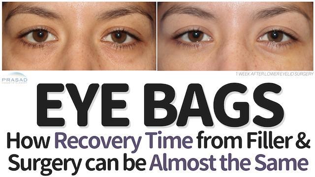 How Healing Time From Eye Bag Surgery And Under Eye Fillers Can Be ...