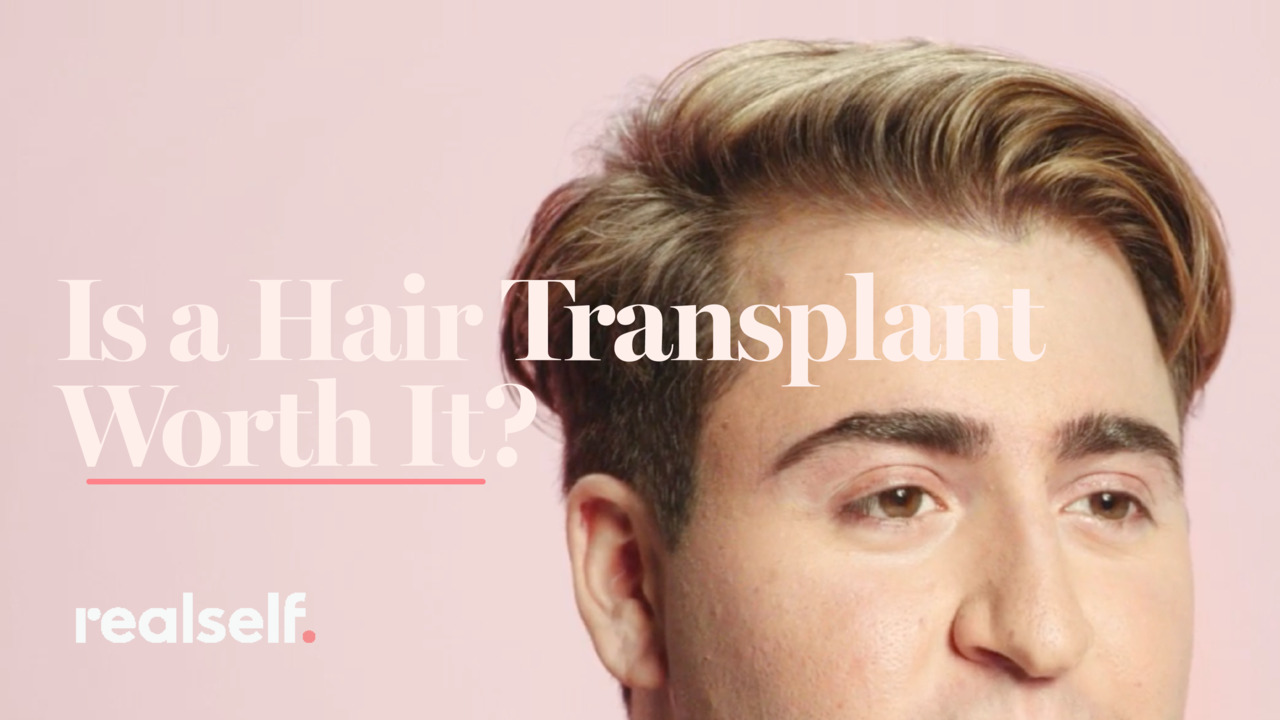 FUE Hair Transplant Treatment Reviews, Photos, and Safety | RealSelf
