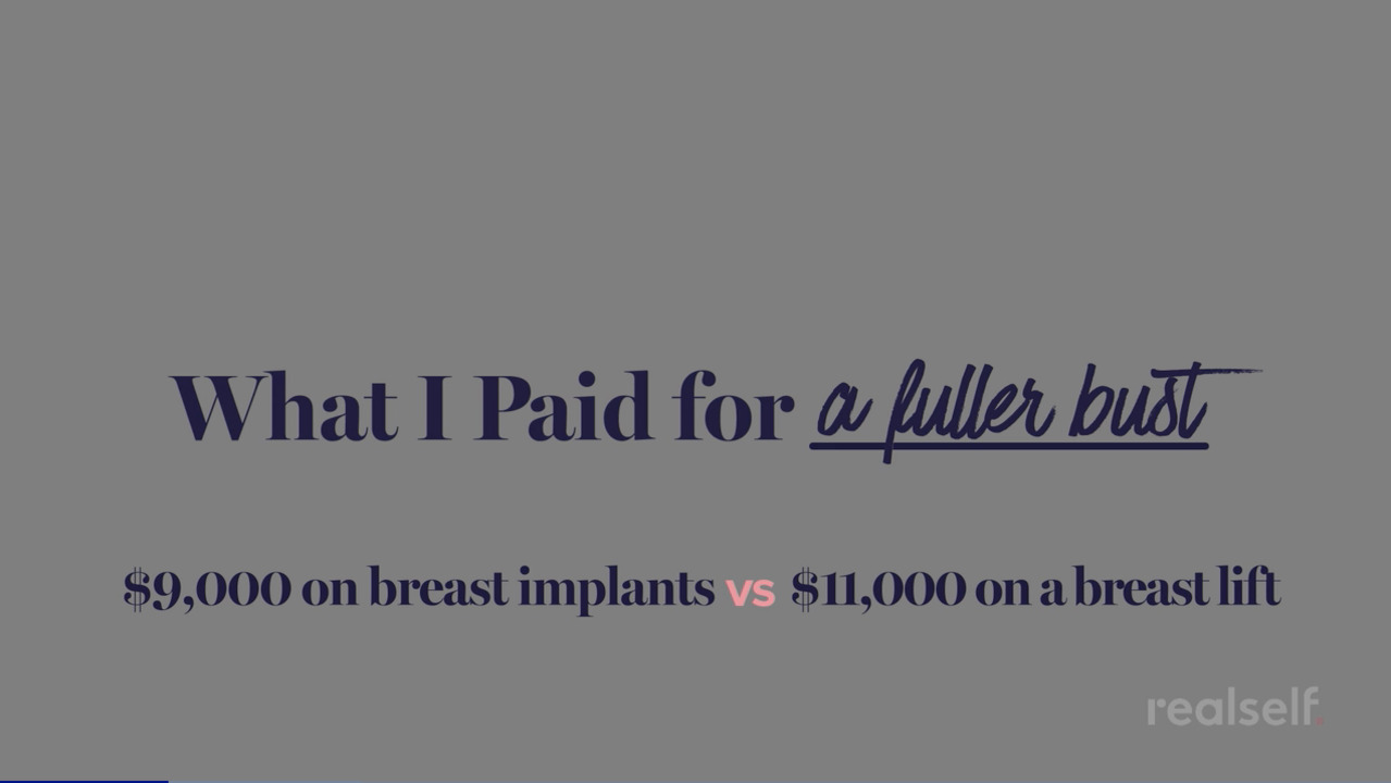 The Most Affordable Breast Implants in 2022: How to Get the Best Price For  You • Gemini Plastic Surgery Aesthetics & Laser Center