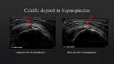 Musculoskeletal Ultrasound of the Extremities: Clinical and Ultrasonographic Correlation