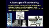 Mobile Bearing vs Fixed Bearing Implants: Differences and Similarities