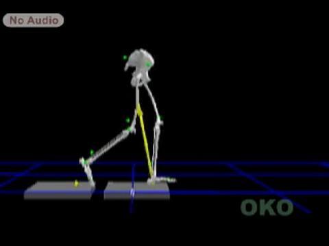 The orthopaedic Management of Cerebral Palsy: Sagittal Plane (Side View). Gait Assessment