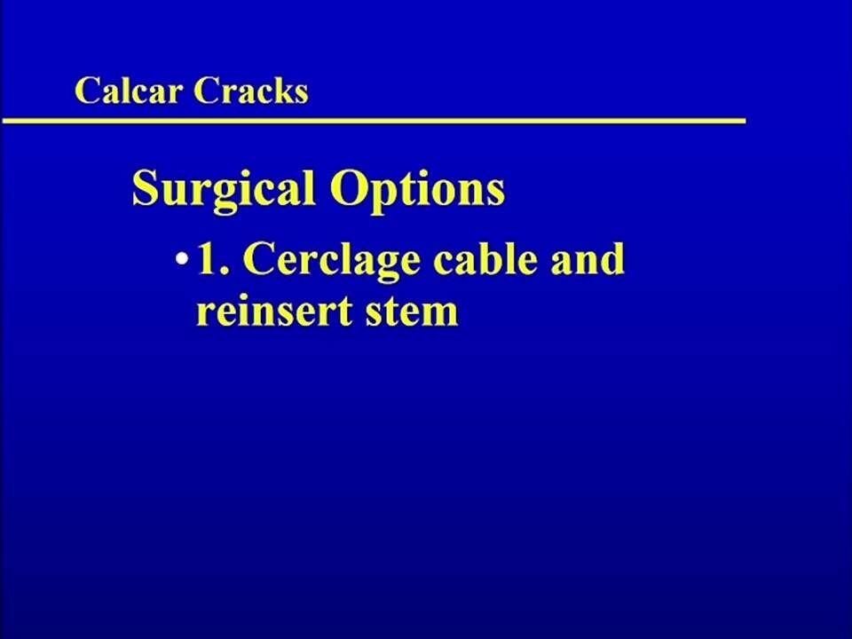 Intra-Operative Femur Fractures: Watch for Calcar Cracks