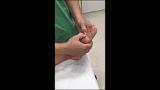 Medial Column Instability 